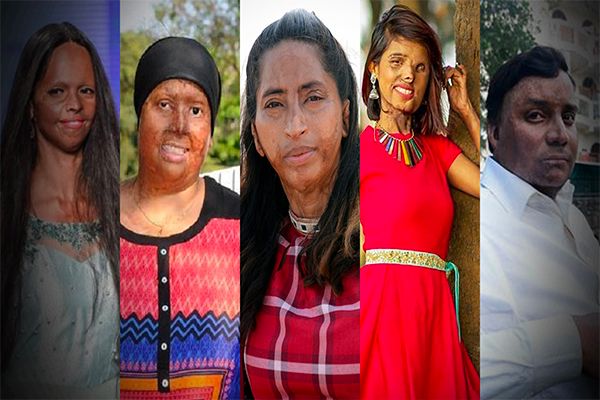 5 Inspiring Acid Attack Survivors