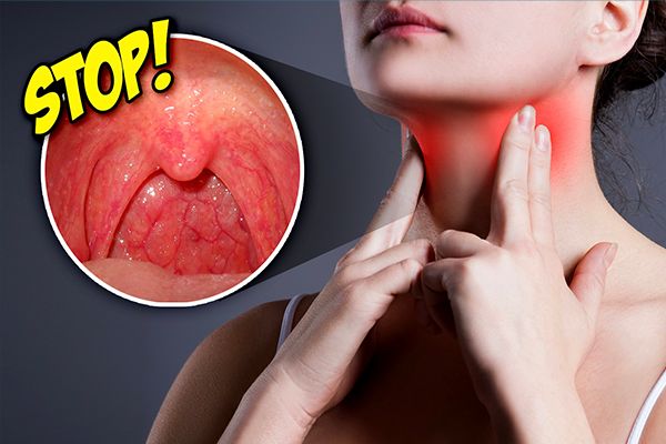 Home Remedies For Sore Throat