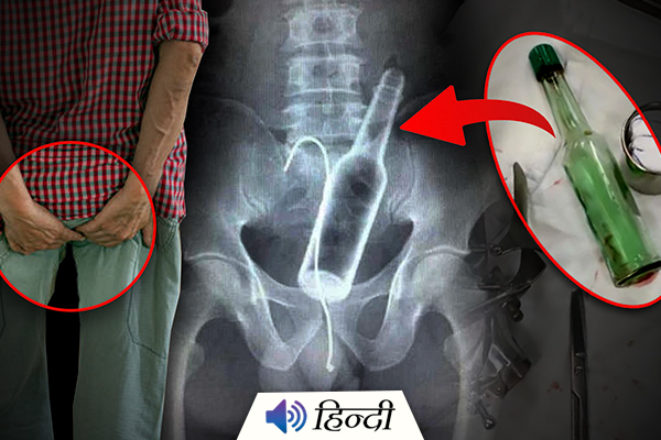 Man Kept Water Bottle Stuck in Anus for 3 Days s