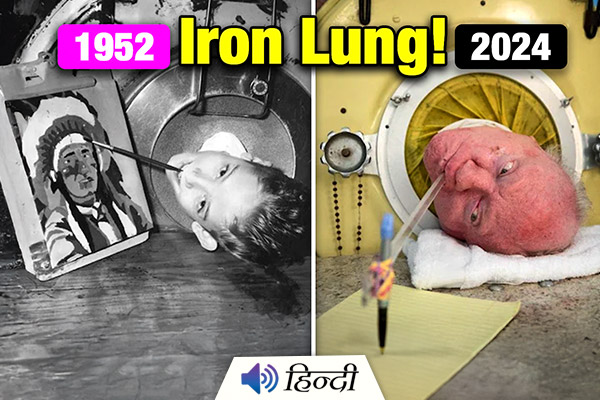 The Story of Paul Alexander: Last Man to Live in an Iron Lung